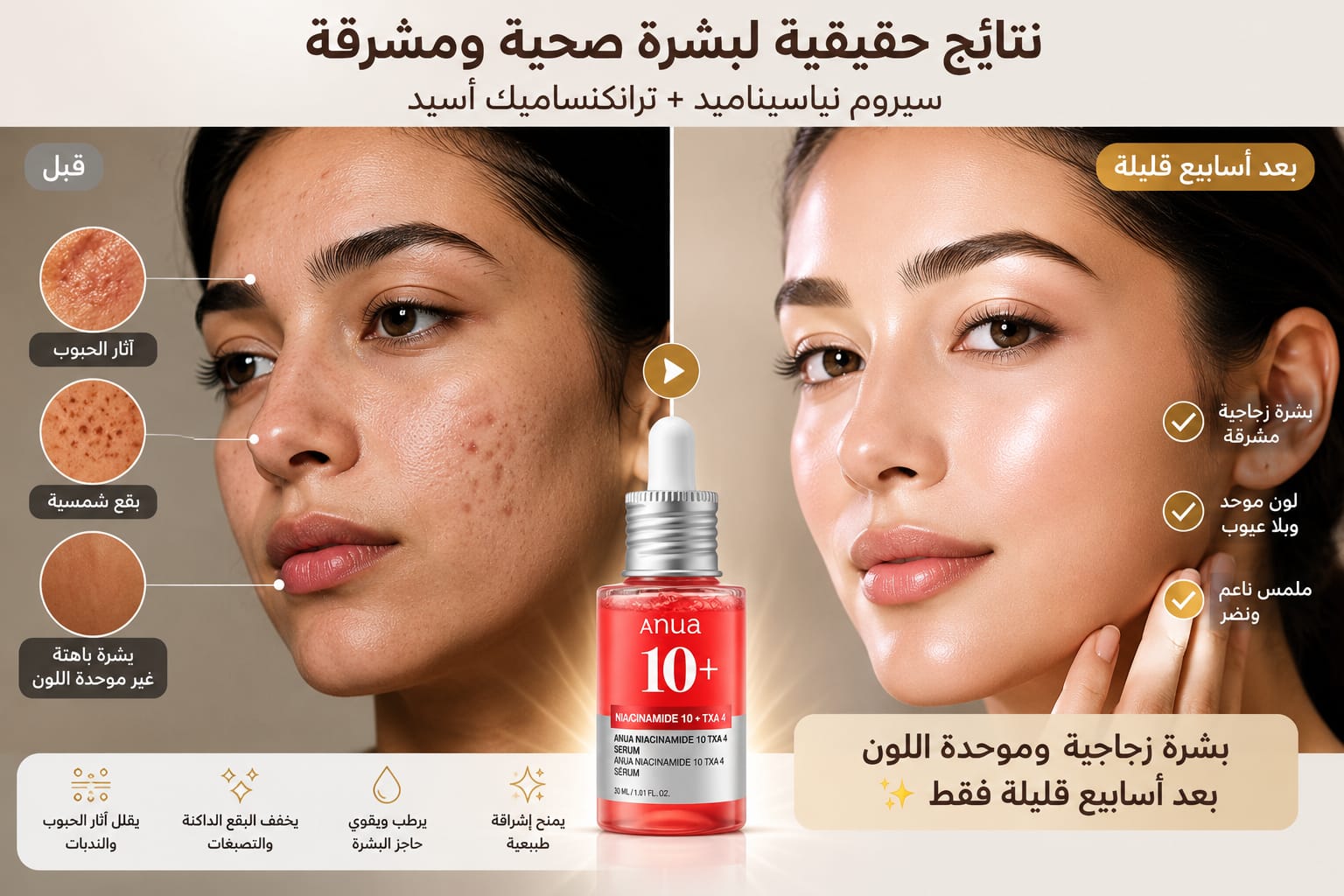 Anua Niacinamide 10% + TXA 4% Dark Spot Correcting Serum